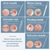 71BRsI8sbgL._AC_SL1500_.jpg JPNK Blackhead Remover Comedone Extractor Acne Removal Kit..