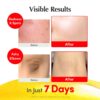 71BmMnxG3wL._SL1500_.jpg EQQUALBERRY Vitamin Illuminating Serum | Niacinamide 4% + Brightening Vitamin C Face Serum with Hyaluronic Acid & Vitamin E | Dark Spot, Uneven Tone Care | Korean Skincare, 1.01 fl.oz