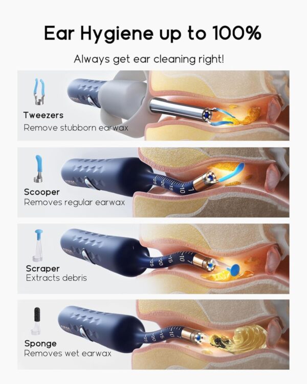 71CRKk0hyBL._AC_SL1500_.jpg Bebird Earsight Plus D39R Ear Wax Removal Tool Camera, FSA HSA Eligible Items, Ear Cleaner with Flexible Ear Camera Otoscope, Visual Ear Pick Tweezers Wax Remover, Ear Cleaning Kit for Family