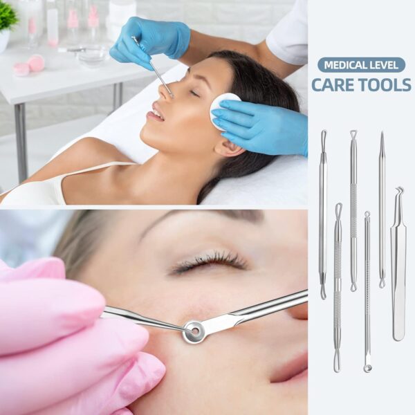 71DHITH9o8L._AC_SL1500_.jpg JPNK Blackhead Remover Comedone Extractor Acne Removal Kit..