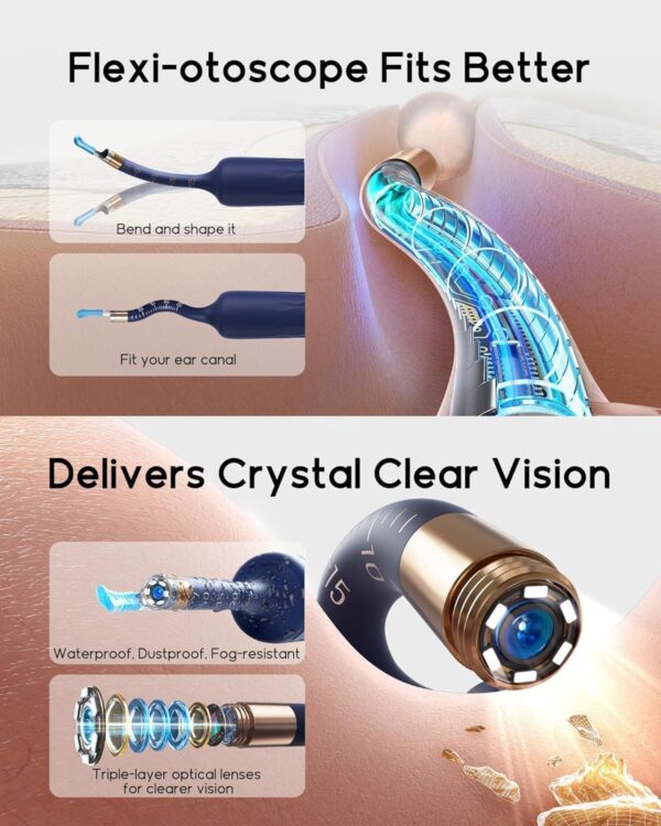 71Dl0y2EK7L._AC_SL1500_.jpg Bebird Earsight Plus D39R Ear Wax Removal Tool Camera, FSA HSA Eligible Items, Ear Cleaner with Flexible Ear Camera Otoscope, Visual Ear Pick Tweezers Wax Remover, Ear Cleaning Kit for Family