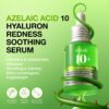71IFzYSuOzL._SL1500_.jpg Anua Azelaic Acid 10 Hyaluron Redness Soothing Serum, Facial Serum for Blemish-Prone & Oily-Prone Skin, Lightweight & Hydrating Blemish Care, Hyaluronic Acid, Korean Skincare, 1.01 fl oz.