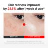71Ss-v6d0L._SL1500_.jpg CENTELLIAN 24 Madeca Cream Time Reverse (1.69 fl oz) - TECA Centella Asiatica Glow Face Cream Moisturizer, Hydrating, Firming, Smoother Even-Looking Skin, Helps Improve Skin Elasticity,Korean Skincare