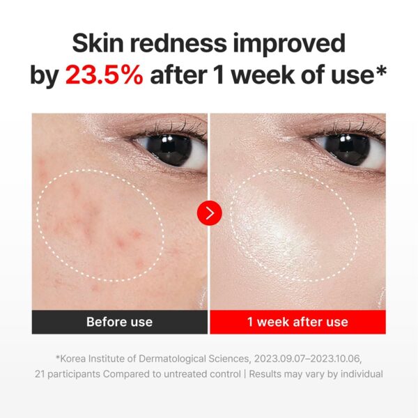 71Ss-v6d0L._SL1500_.jpg CENTELLIAN 24 Madeca Cream Time Reverse (1.69 fl oz) - TECA Centella Asiatica Glow Face Cream Moisturizer, Hydrating, Firming, Smoother Even-Looking Skin, Helps Improve Skin Elasticity,Korean Skincare