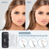 71TWzrVQX2L._AC_SL1500_.jpg JPNK Blackhead Remover Comedone Extractor Acne Removal Kit..