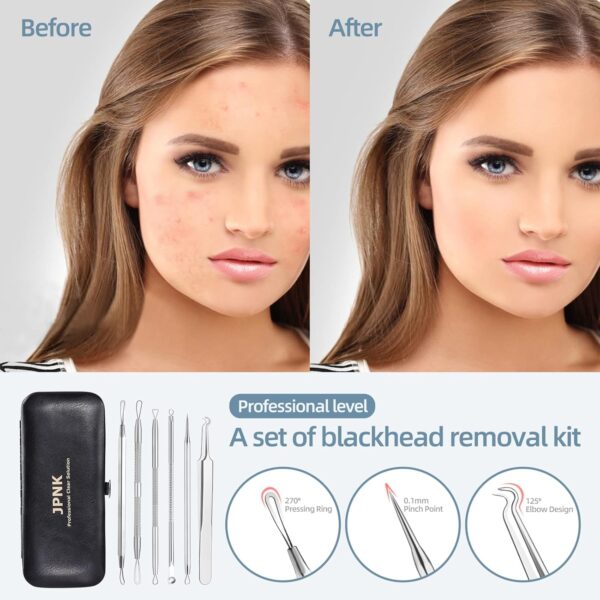 71TWzrVQX2L._AC_SL1500_.jpg JPNK Blackhead Remover Comedone Extractor Acne Removal Kit..