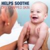 71YhharS75L._SL1500_.jpg Aquaphor Baby Healing Balm Stick With Avocado Oil and Shea Butter, 0.65 Oz Stick