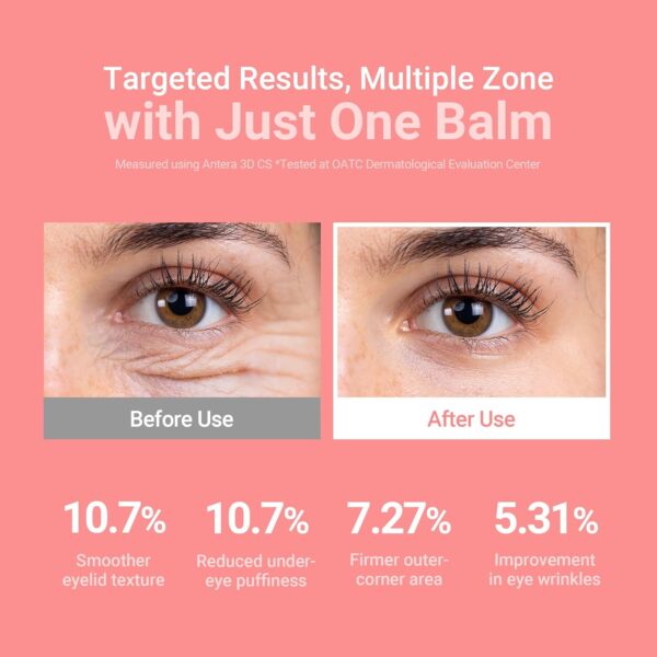 71YohqlR04L._SL1500_.jpg KAHI Wrinkle Bounce Multi Balm Stick | PDRN Collagen Wrinkle Stick | Korean Skin Care |All-in-One Hydrating Lip Balm Eye Cream Neck Cream Make Up Base & Face Mist Moisture Balm