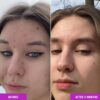 71pqAeCLDWL._SL1500_.jpg Good Molecules Niacinamide Serum - 10% Niacinamide to Target Blemishes, Nourishment, and Skin Tone - Ultra Hydrating Serum and Brightening Skin Care for Face