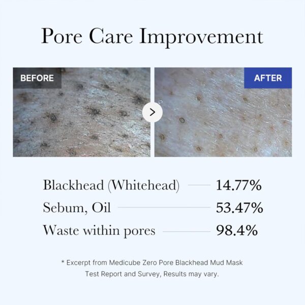 71q7lf2zIwL._SL1500_.jpg Medicube Zero Pore Blackhead Mud Facial Mask - Skin Cooling & Pore Tightening - 3 Minute Quick Dry Formula with AHA, BHA, PHA, and Pore-Purifying Clay - Korean Mud Mask 3.52 oz