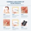 71uT0ihahnL._AC_SL1500_.jpg JPNK Blackhead Remover Comedone Extractor Acne Removal Kit..