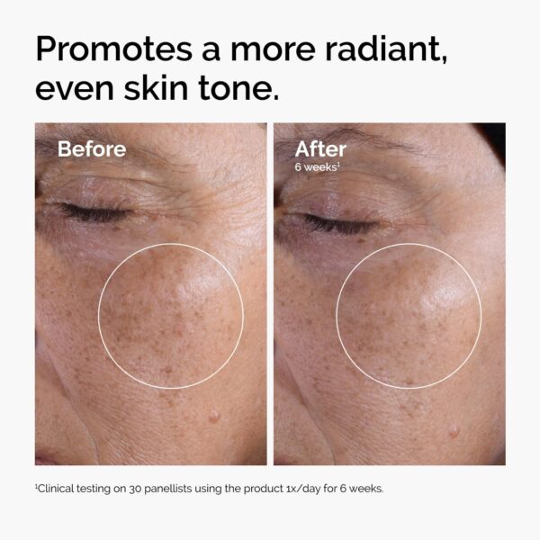 71zRAnbXbcL._SL1240_.jpg The Ordinary Glycolic Acid 7% Exfoliating Toner, Brightening and Smoothing Daily Toner for More Even-Looking Skin Tone