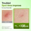 81WWHolwkFL._SL1500_.jpg Anua Azelaic Acid 10 Hyaluron Redness Soothing Serum, Facial Serum for Blemish-Prone & Oily-Prone Skin, Lightweight & Hydrating Blemish Care, Hyaluronic Acid, Korean Skincare, 1.01 fl oz.